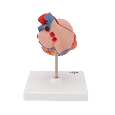 3B Scientific 2-Part Anatomical Heart Model with Left Ventricular Hypertrophy